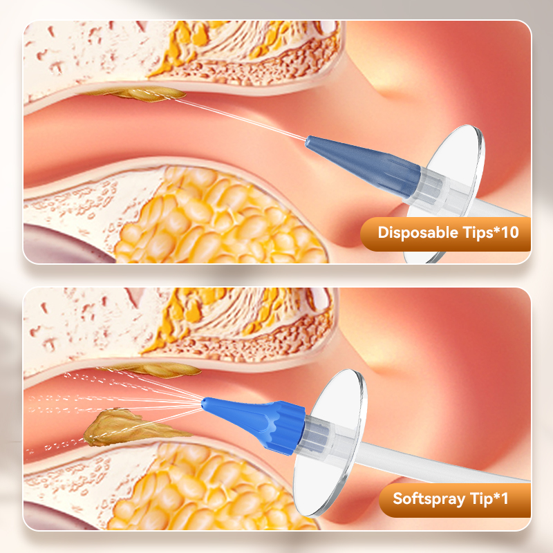 Ear Wax Remoção Manual Ear Irr - Urban Farming System avaliação e preço